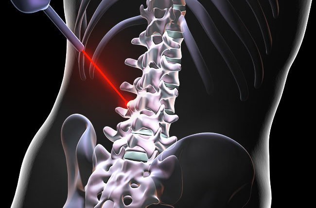 Spine and Cord Surgery